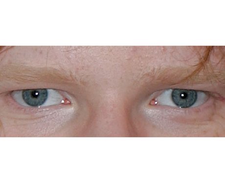 eyes guess celebrity ed sheeran