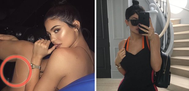 The Story Of How Kylie Jenner Got That Scar On Her Leg Has Finally Answered All Our Capital 5731
